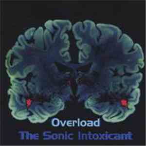 NeuroPop - Overload: The Sonic Intoxicant download mp3 flac